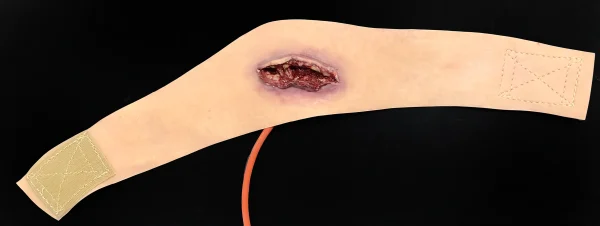 Neck wound