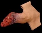 Leg amputation with bone