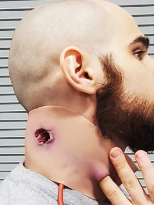 Gunshot wound neck (packable)